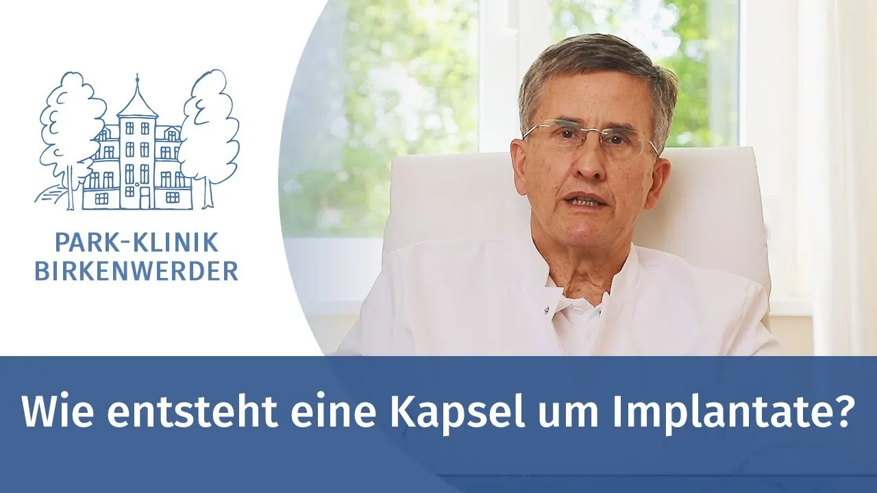 Vorschaubild: Wie entsteht eine Kapsel um Implantate?