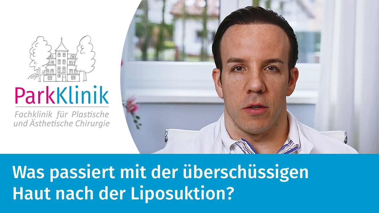 Vorschaubild: Was passiert mit der überschüssigen Haut nach der Liposuktion?